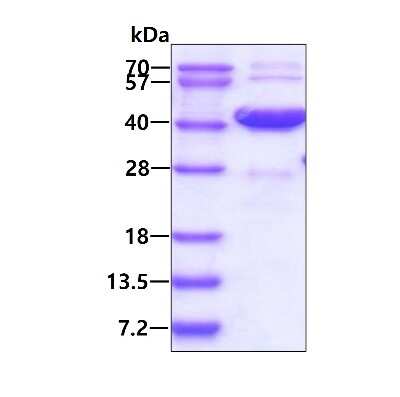 SDS-PAGE: Recombinant Human MAD2L1-binding protein His Protein [NBP1-99078]